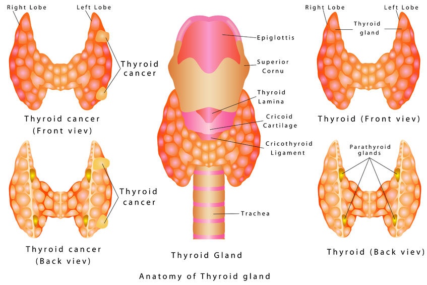 Follicular Thyroid Cancer Drug